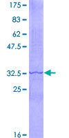 12.5% SDS-PAGE Stained with Coomassie Blue.